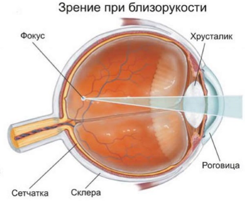 Sélection de lunettes en fonction de la forme du visage d'une femme pour la vision, la protection solaire. Règles. Actualités mode 2020