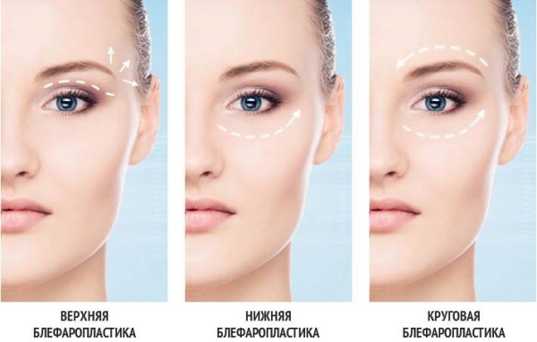 Des yeux enfoncés. Photo, ce qui signifie comment déterminer, corriger chez la femme: maquillage, plastique, chirurgie